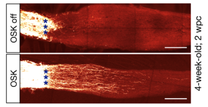 Fig 5. Reversing blindness in mice with OSK