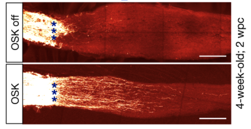 Fig 2. Reversing blindness in mice with OSK